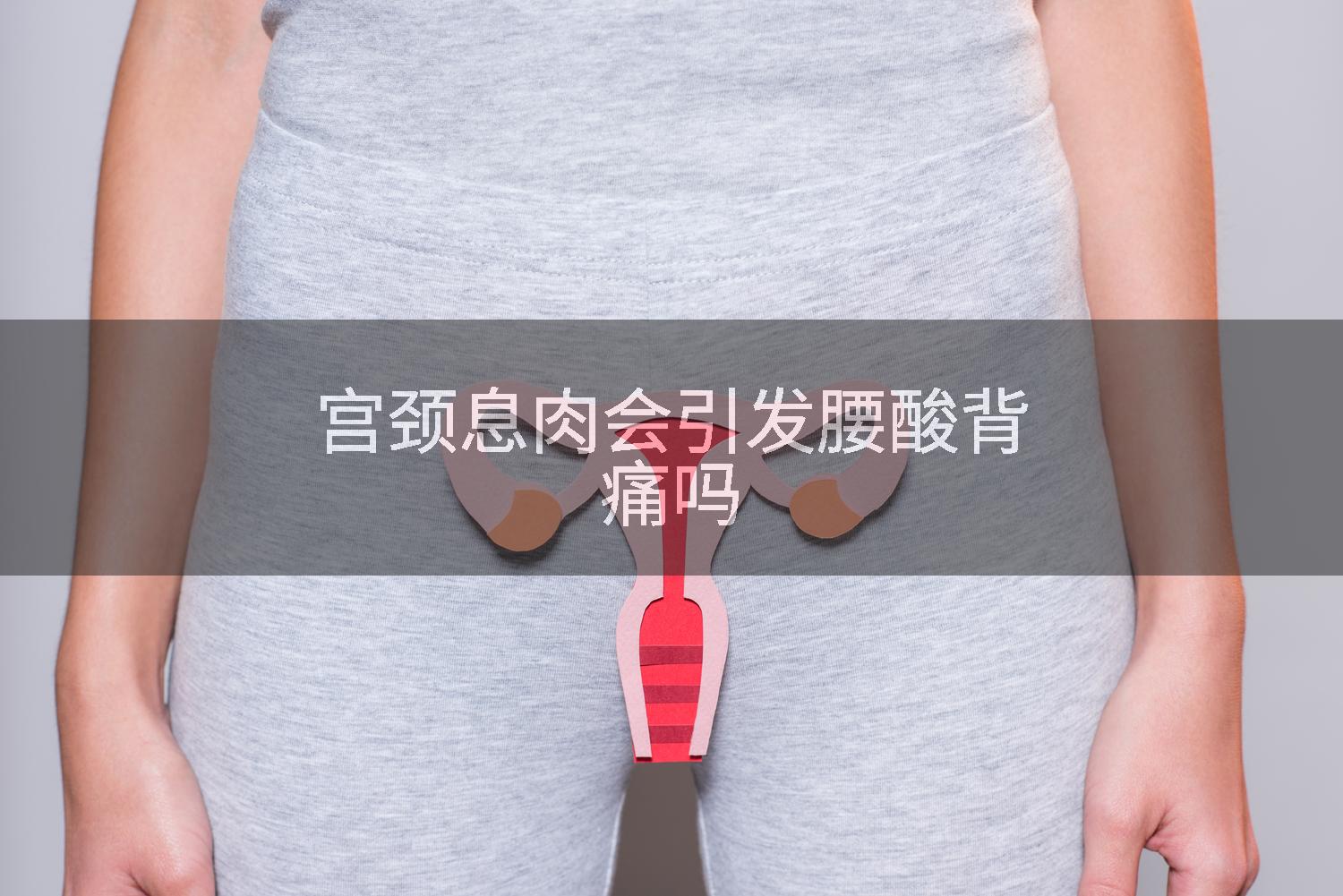 宫颈息肉会引发腰酸背痛吗