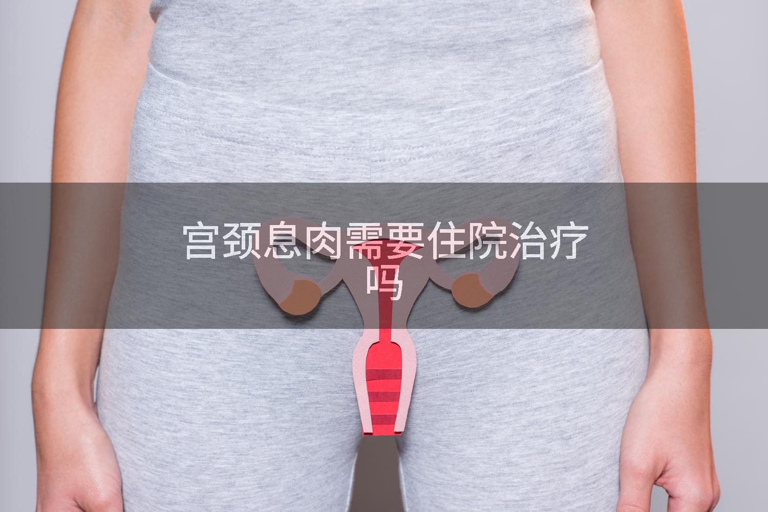 宫颈息肉需要住院治疗吗