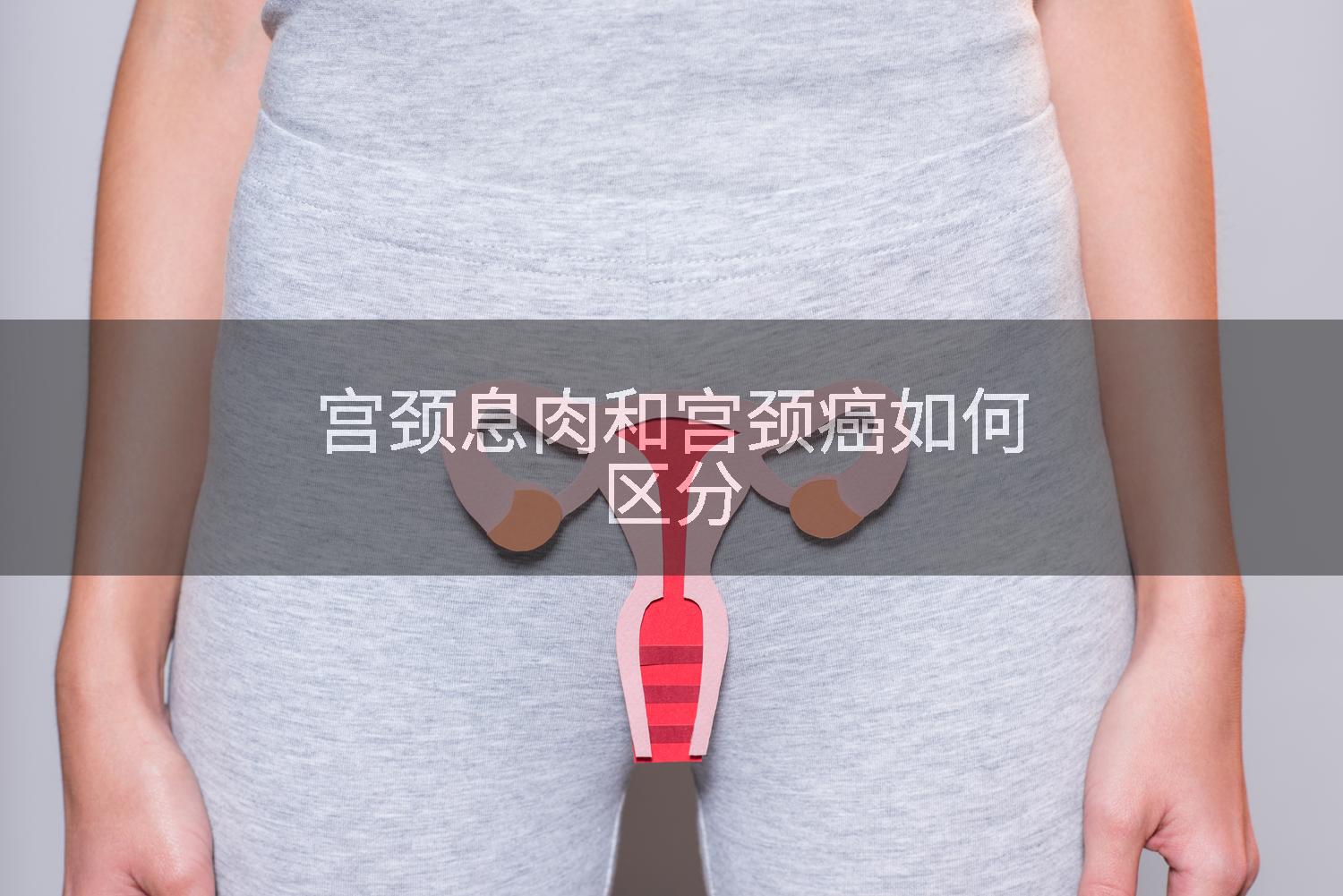 宫颈息肉和宫颈癌如何区分