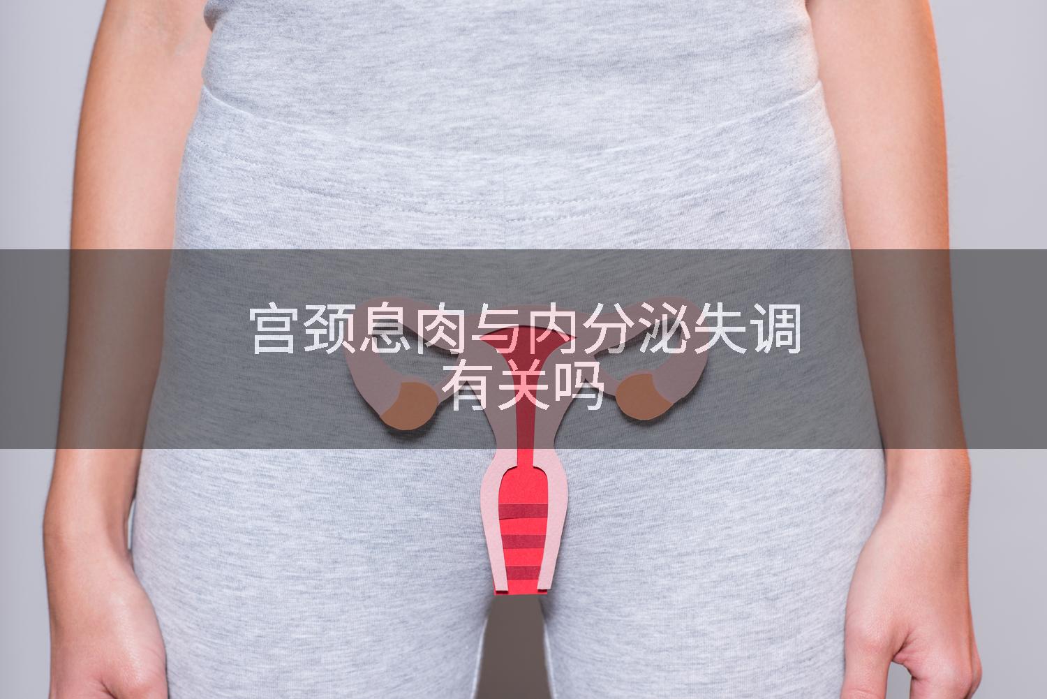 宫颈息肉与内分泌失调有关吗