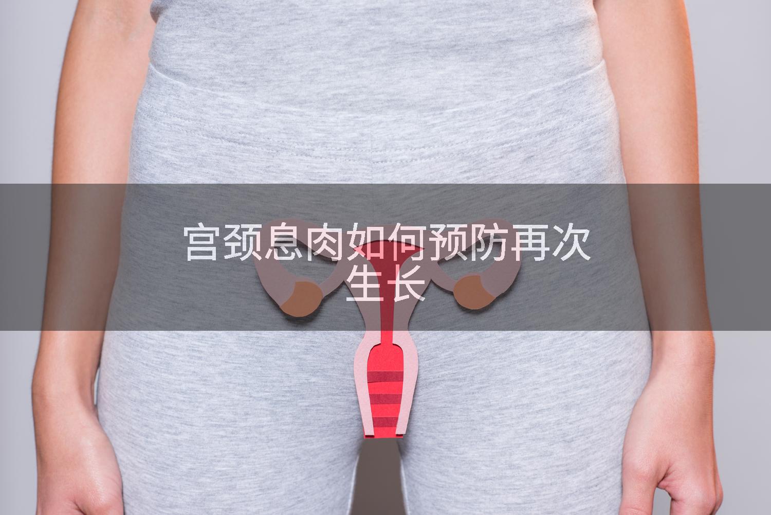 宫颈息肉如何预防再次生长