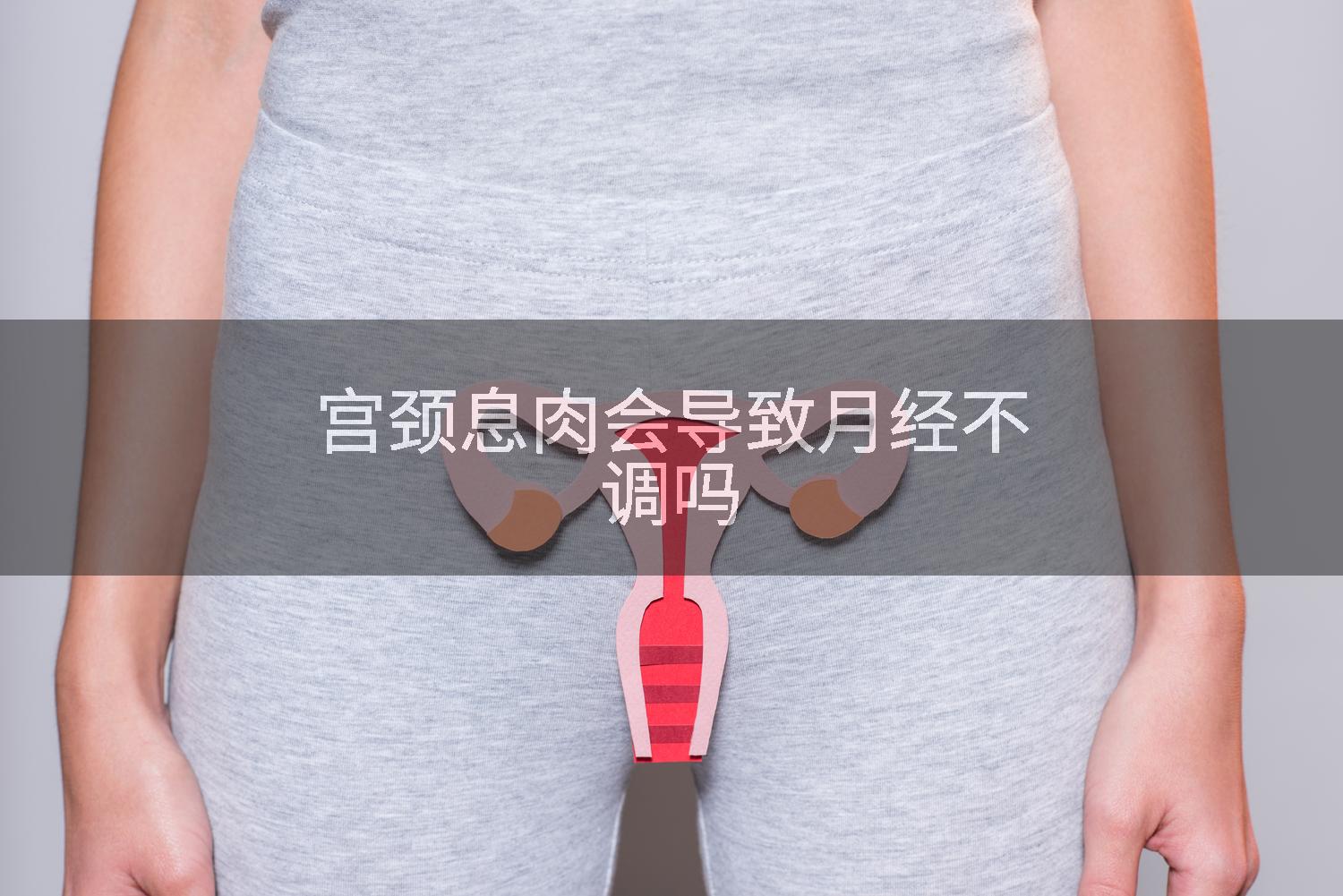 宫颈息肉会导致月经不调吗