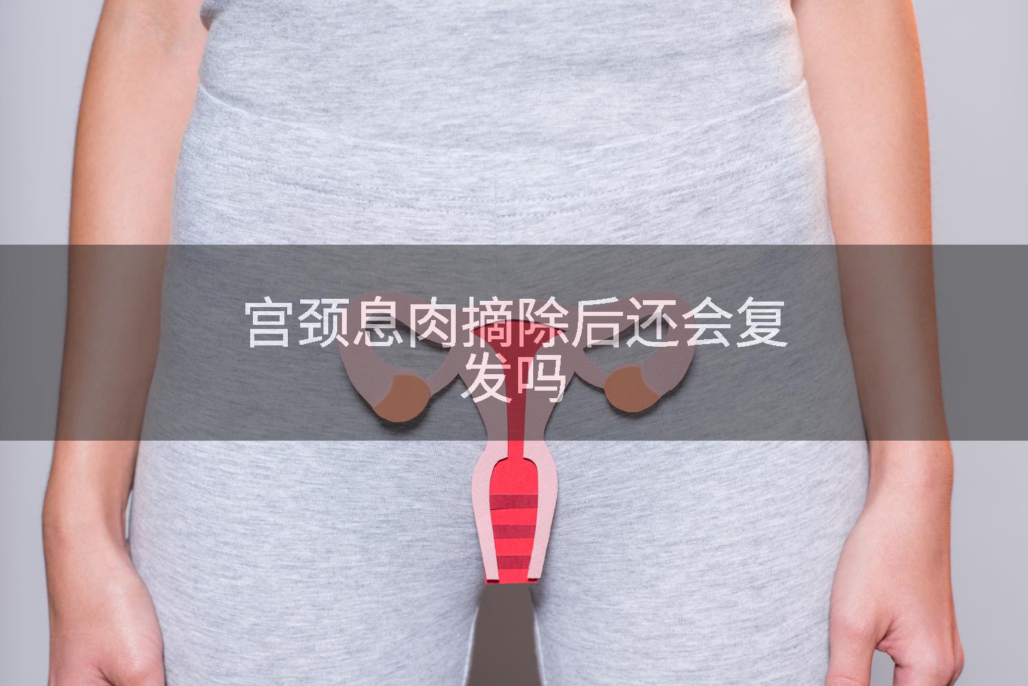 宫颈息肉摘除后还会复发吗