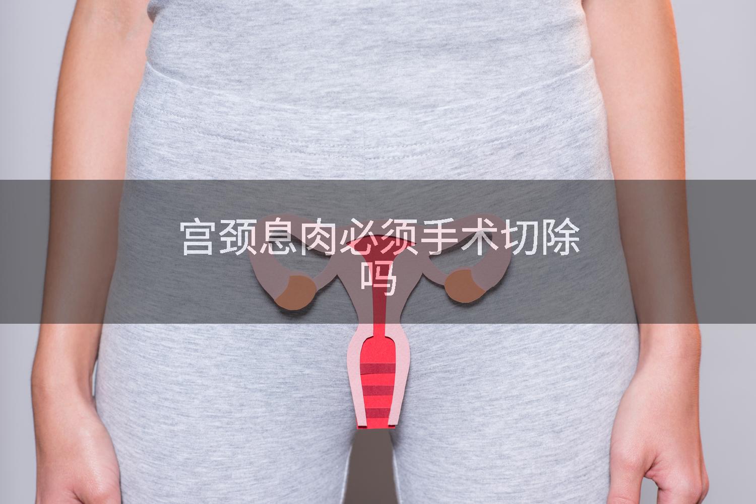 宫颈息肉必须手术切除吗