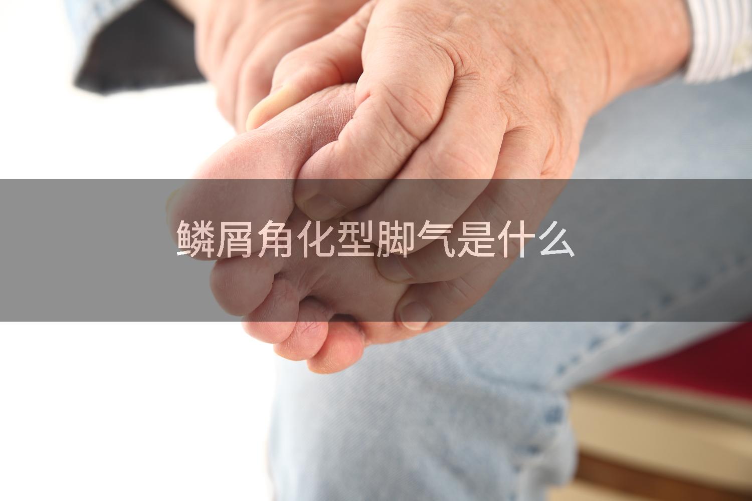 鳞屑角化型脚气是什么