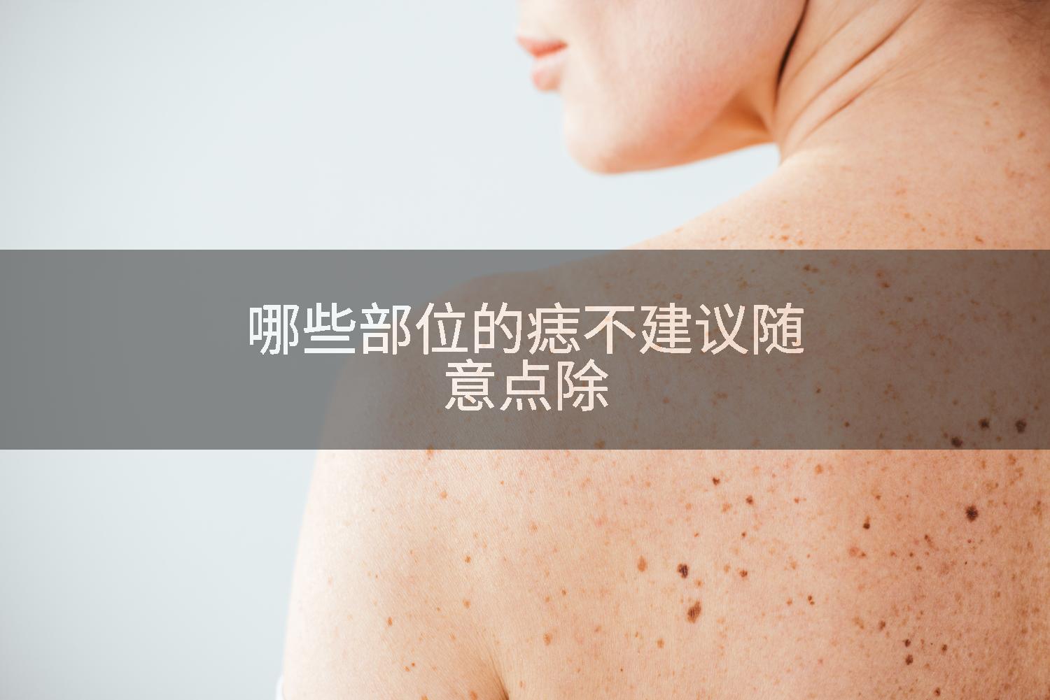 哪些部位的痣不建议随意点除
