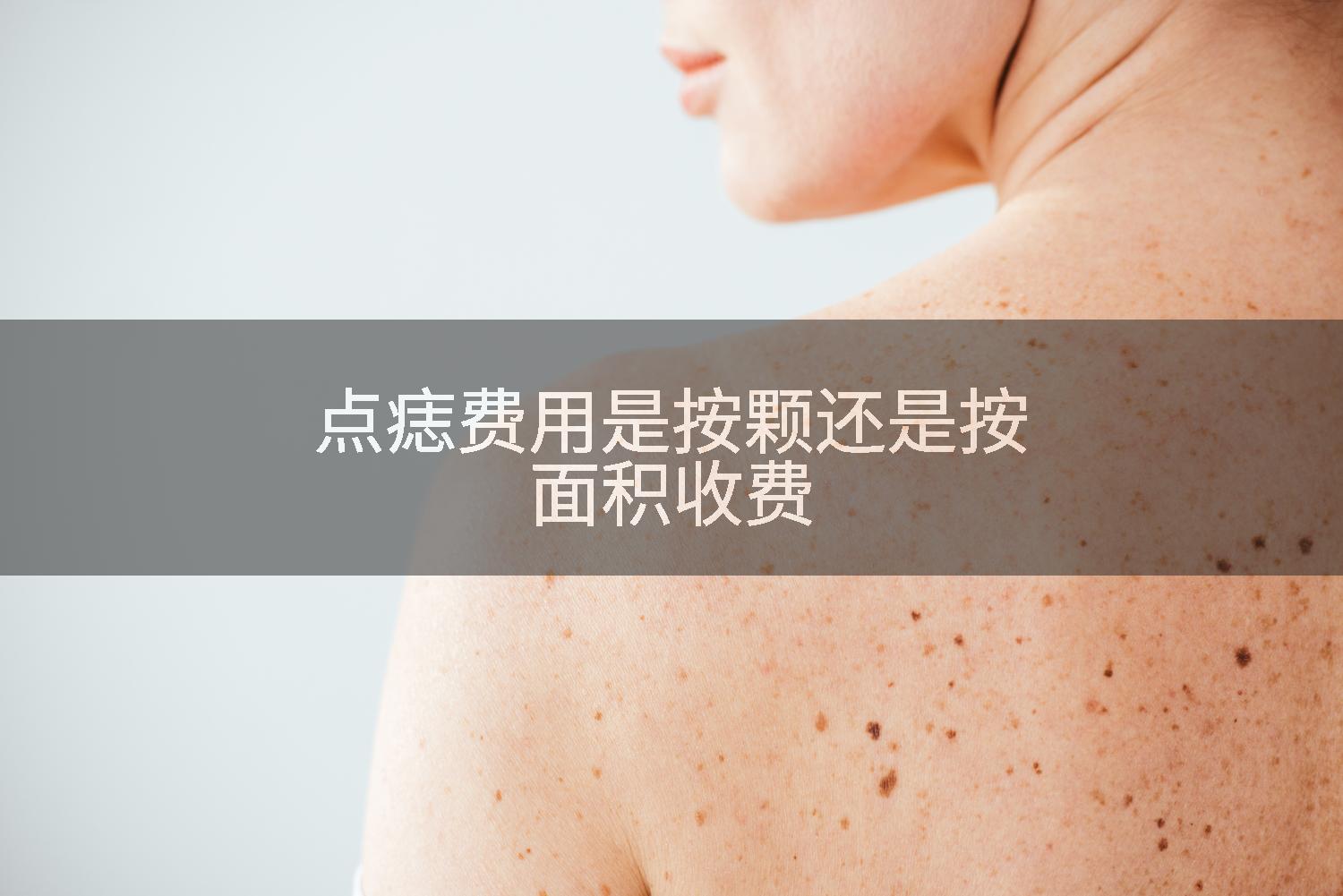 点痣费用是按颗还是按面积收费