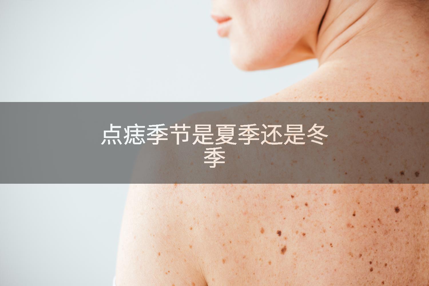点痣季节是夏季还是冬季