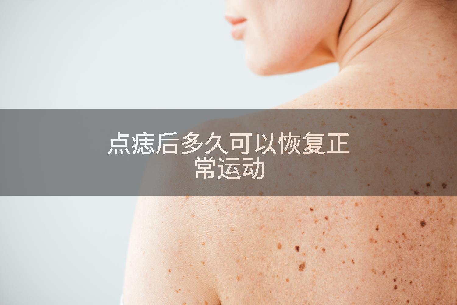 点痣后多久可以恢复正常运动