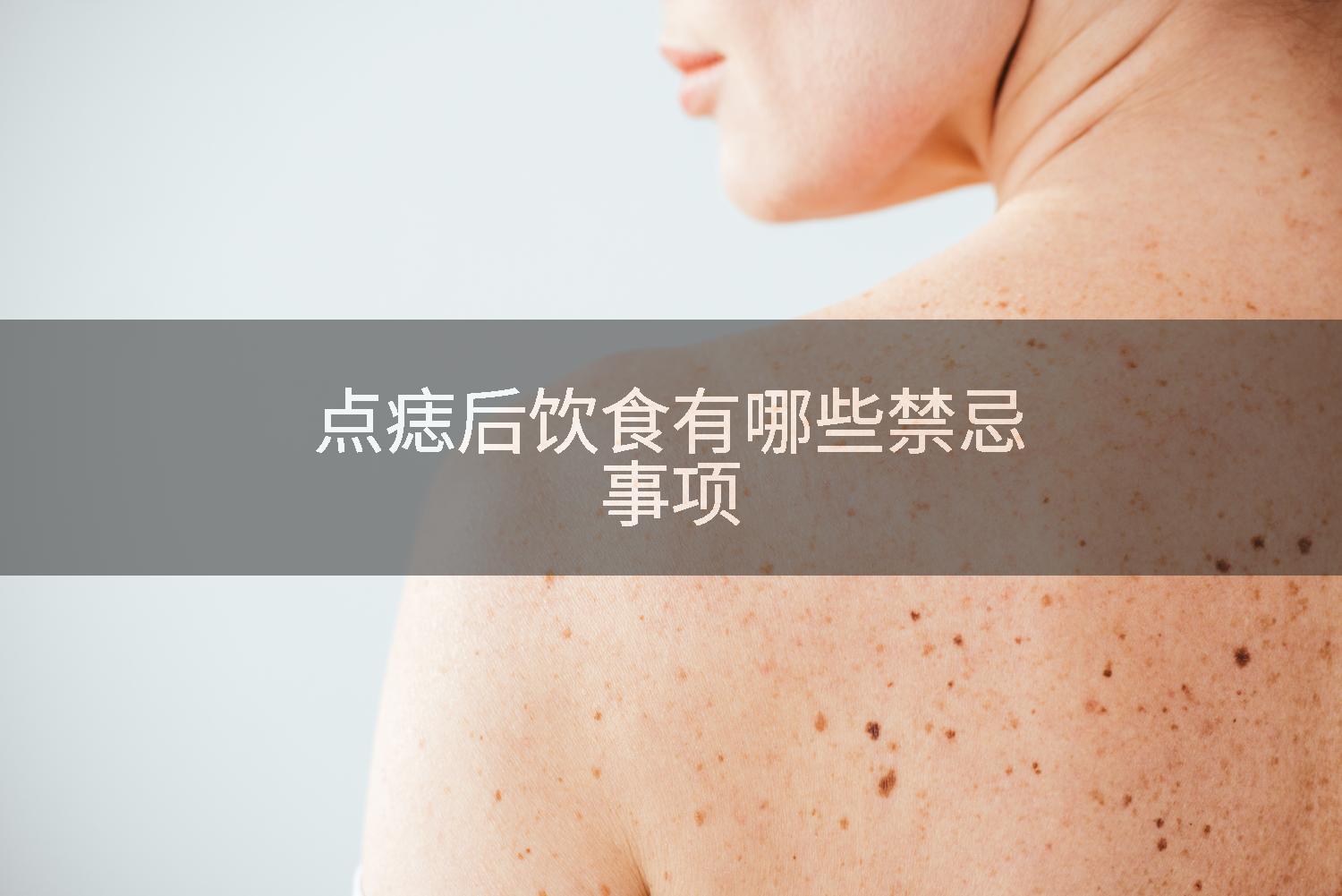 点痣后饮食有哪些禁忌事项
