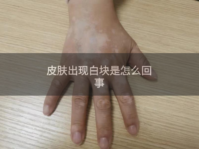 皮肤出现白块是怎么回事
