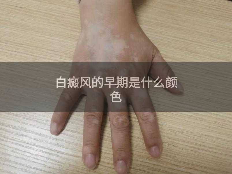 白癜风的早期是什么颜色