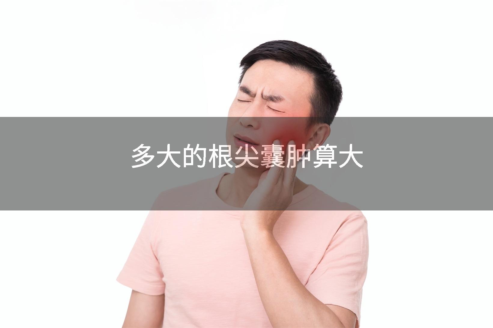 多大的根尖囊肿算大