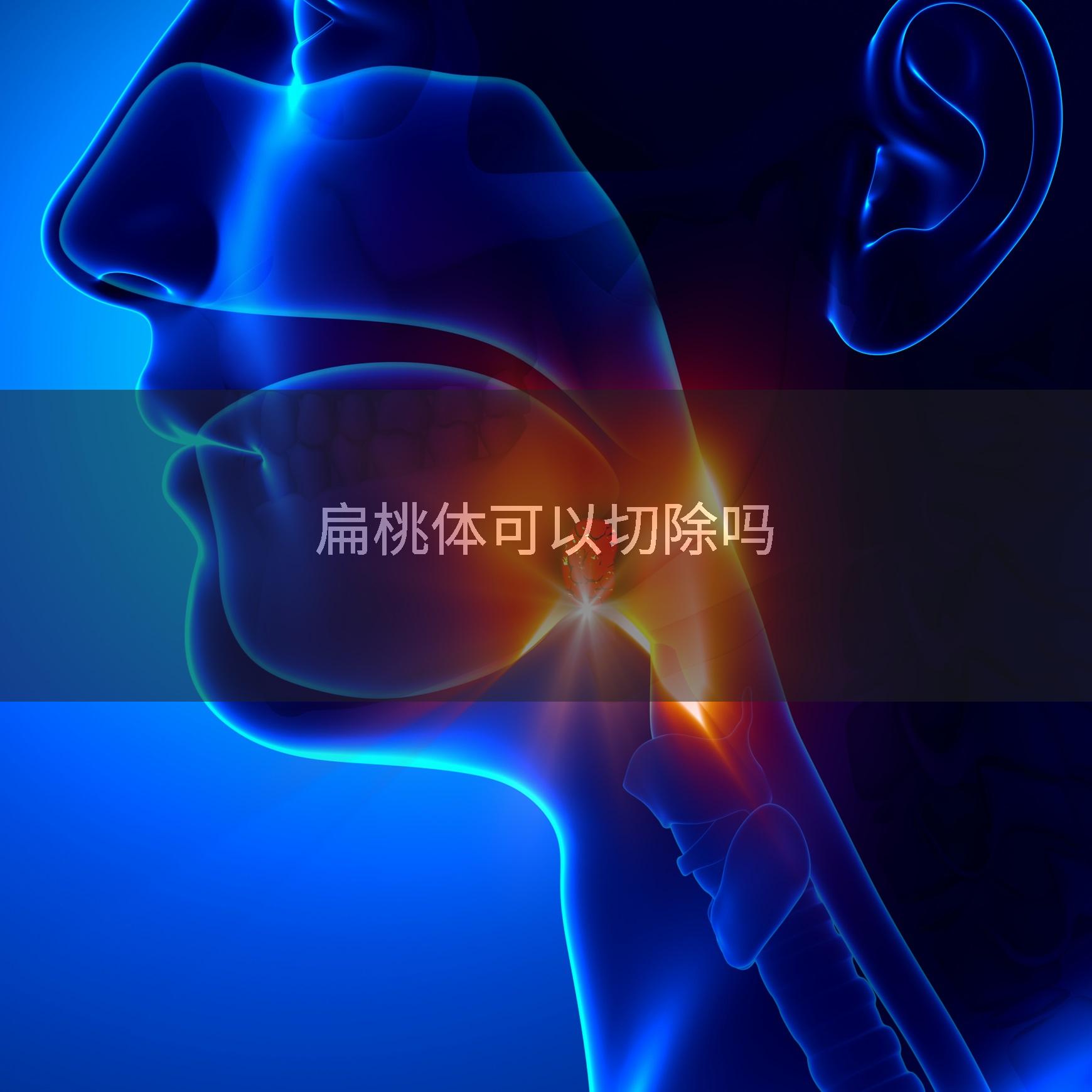 扁桃体可以切除吗