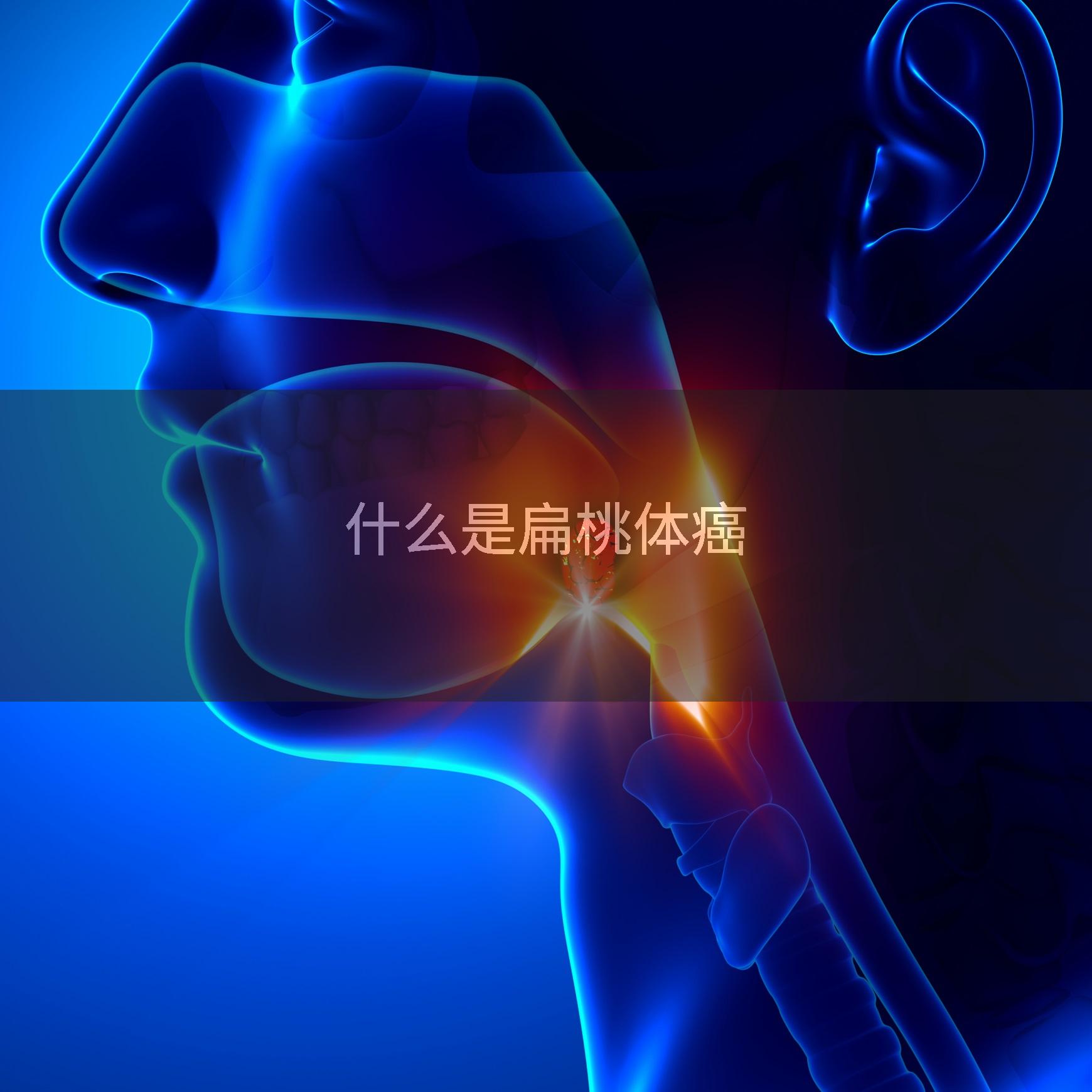 什么是扁桃体癌