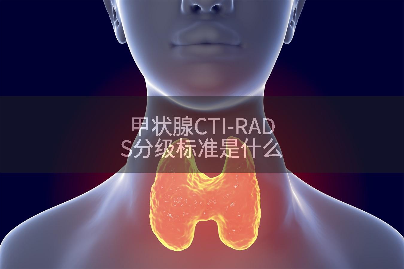 甲状腺CTI-RADS分级标准是什么