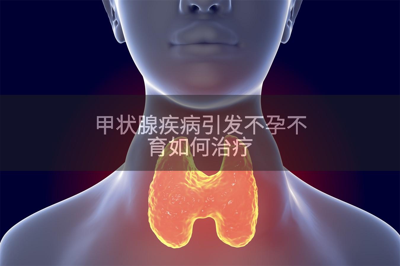 甲状腺疾病引发不孕不育如何治疗