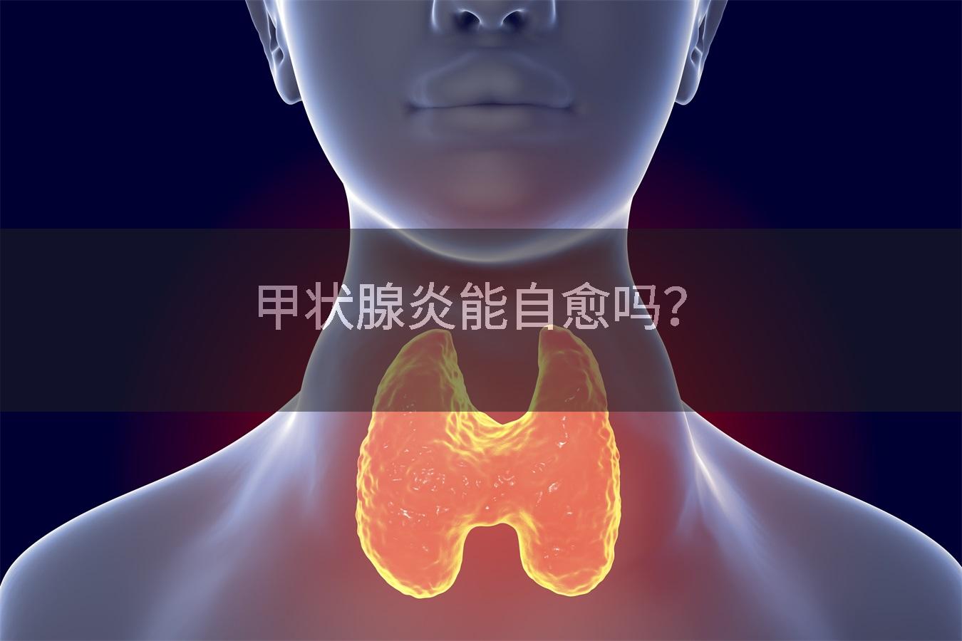 甲状腺炎能自愈吗？