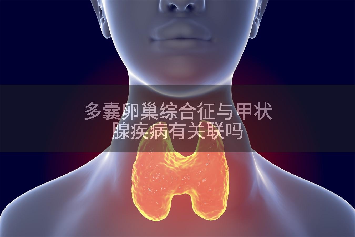 多囊卵巢综合征与甲状腺疾病有关联吗