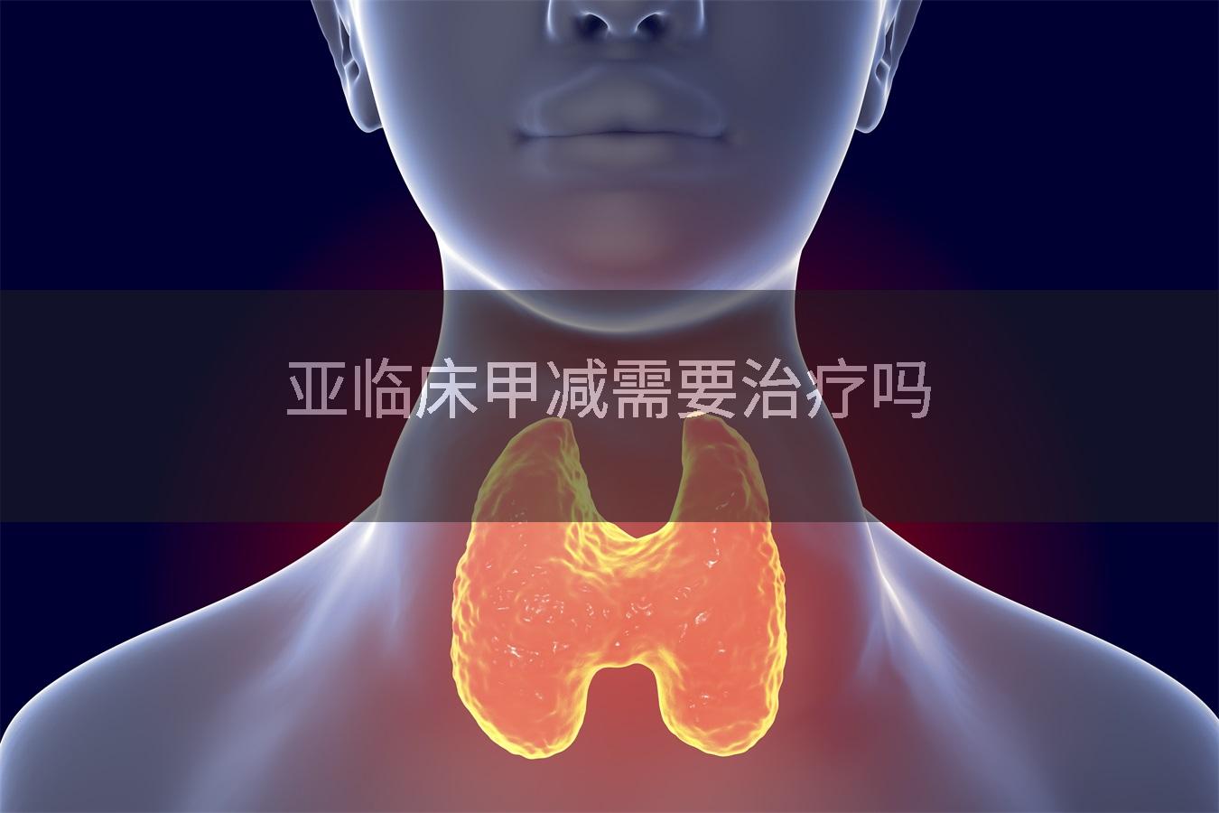 亚临床甲减需要治疗吗