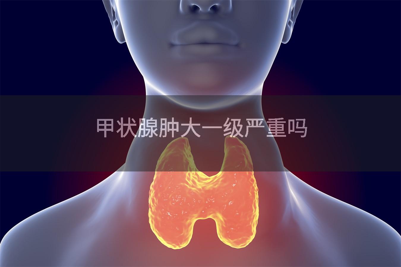 甲状腺肿大一级严重吗