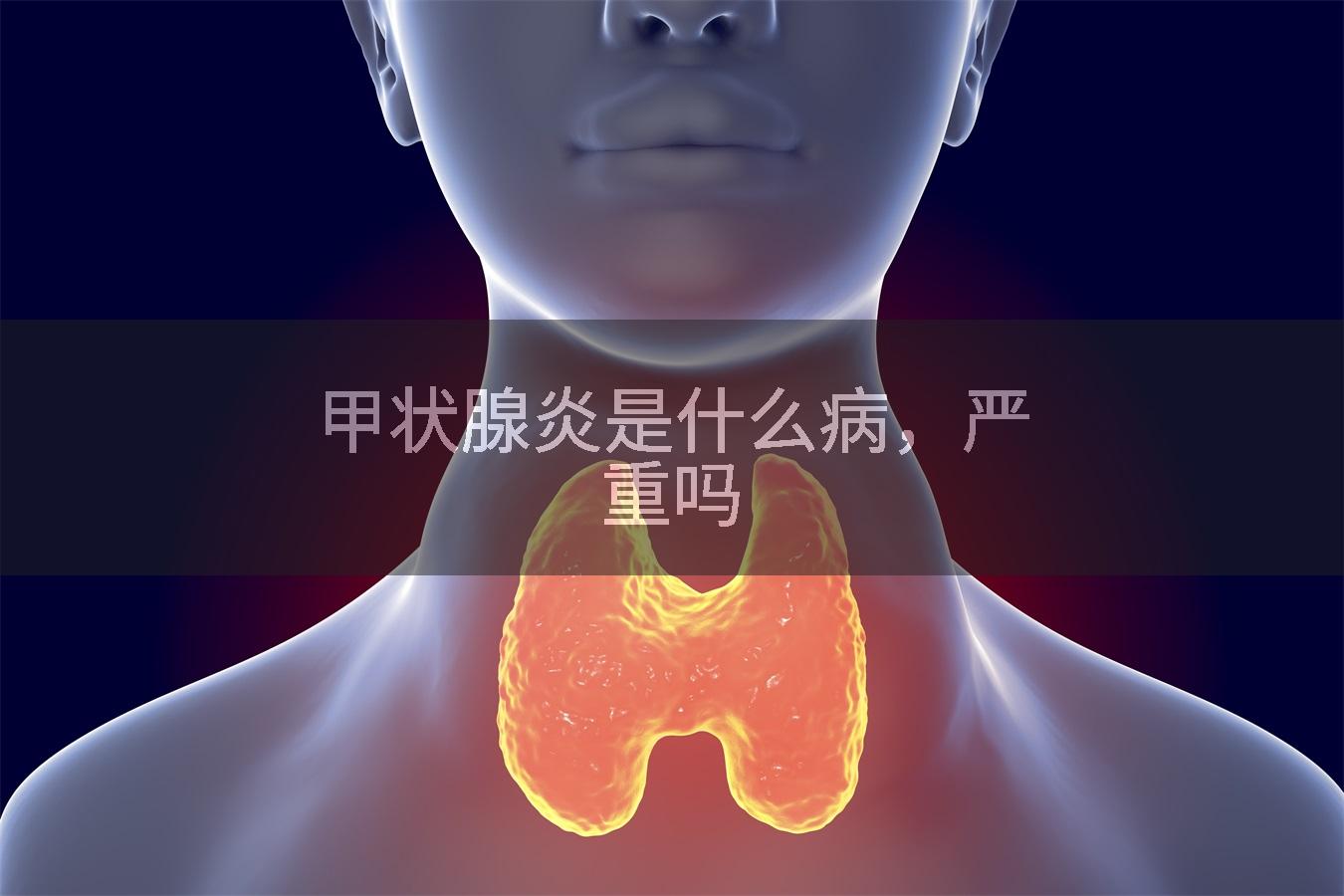 甲状腺炎是什么病，严重吗