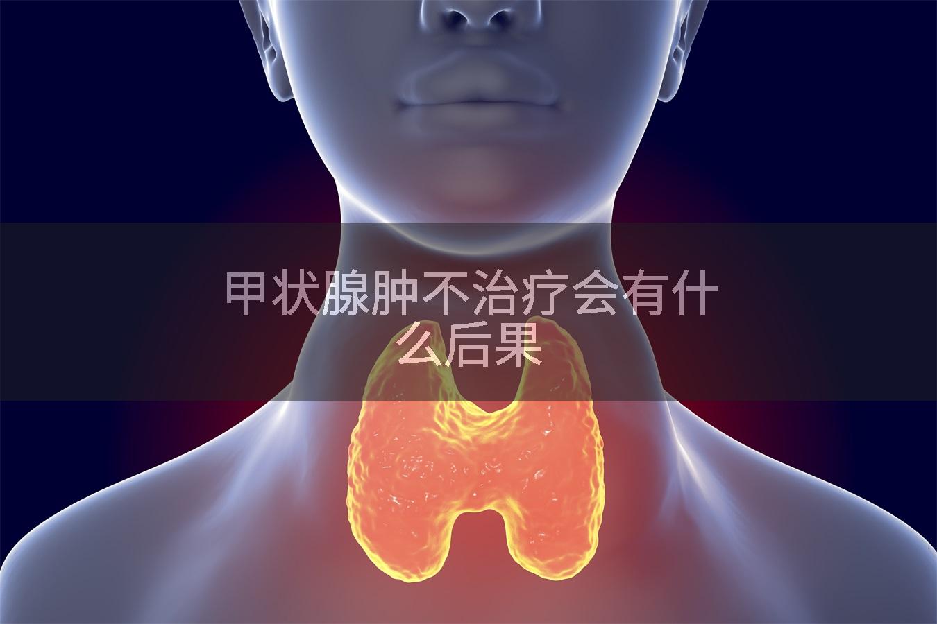 甲状腺肿不治疗会有什么后果