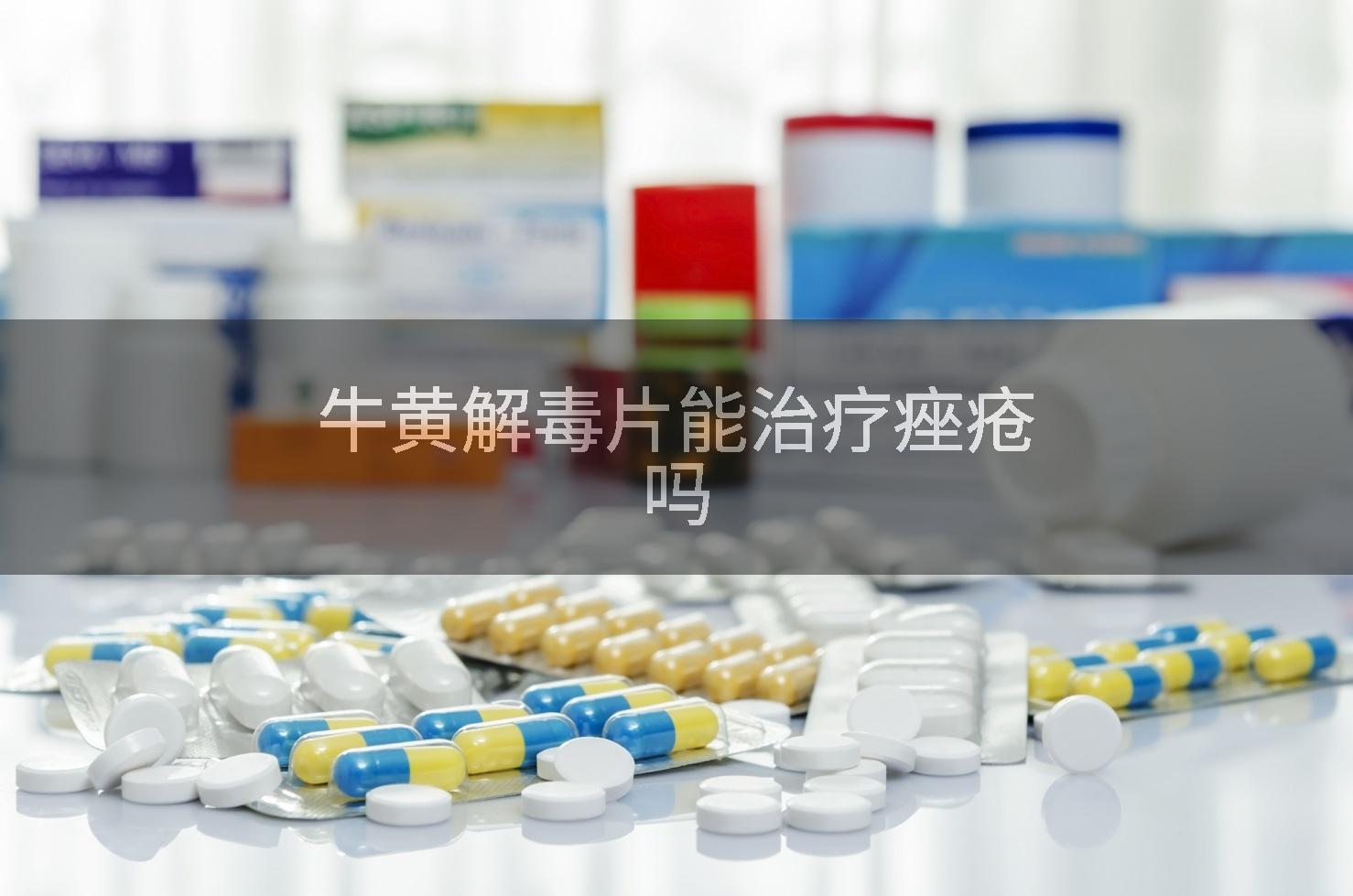 牛黄解毒片能治疗痤疮吗