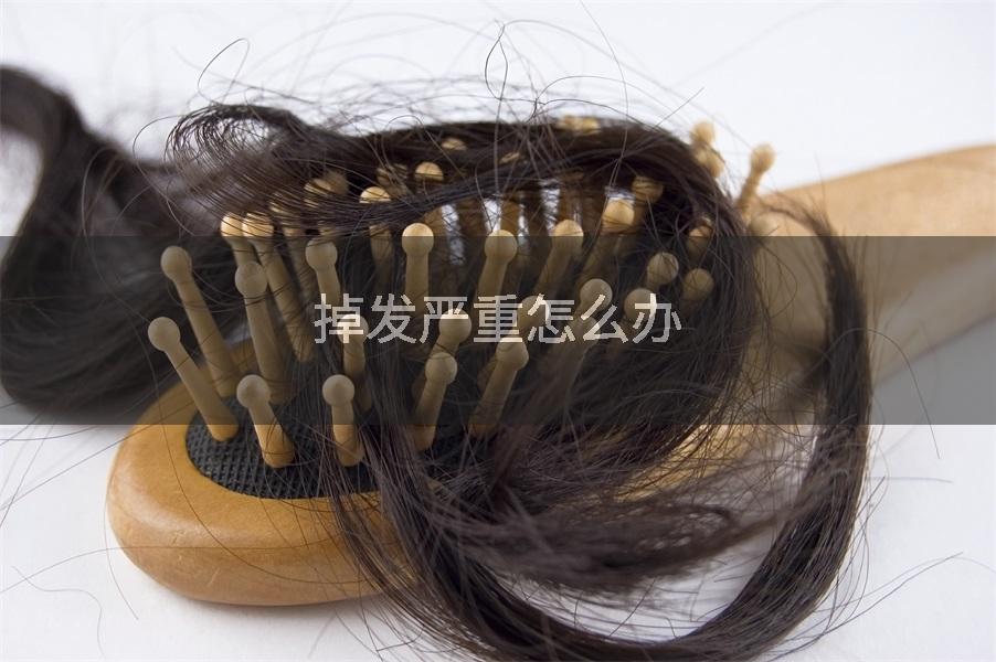 掉发严重怎么办
