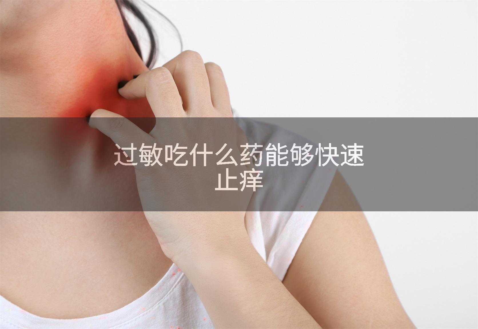 过敏吃什么药能够快速止痒