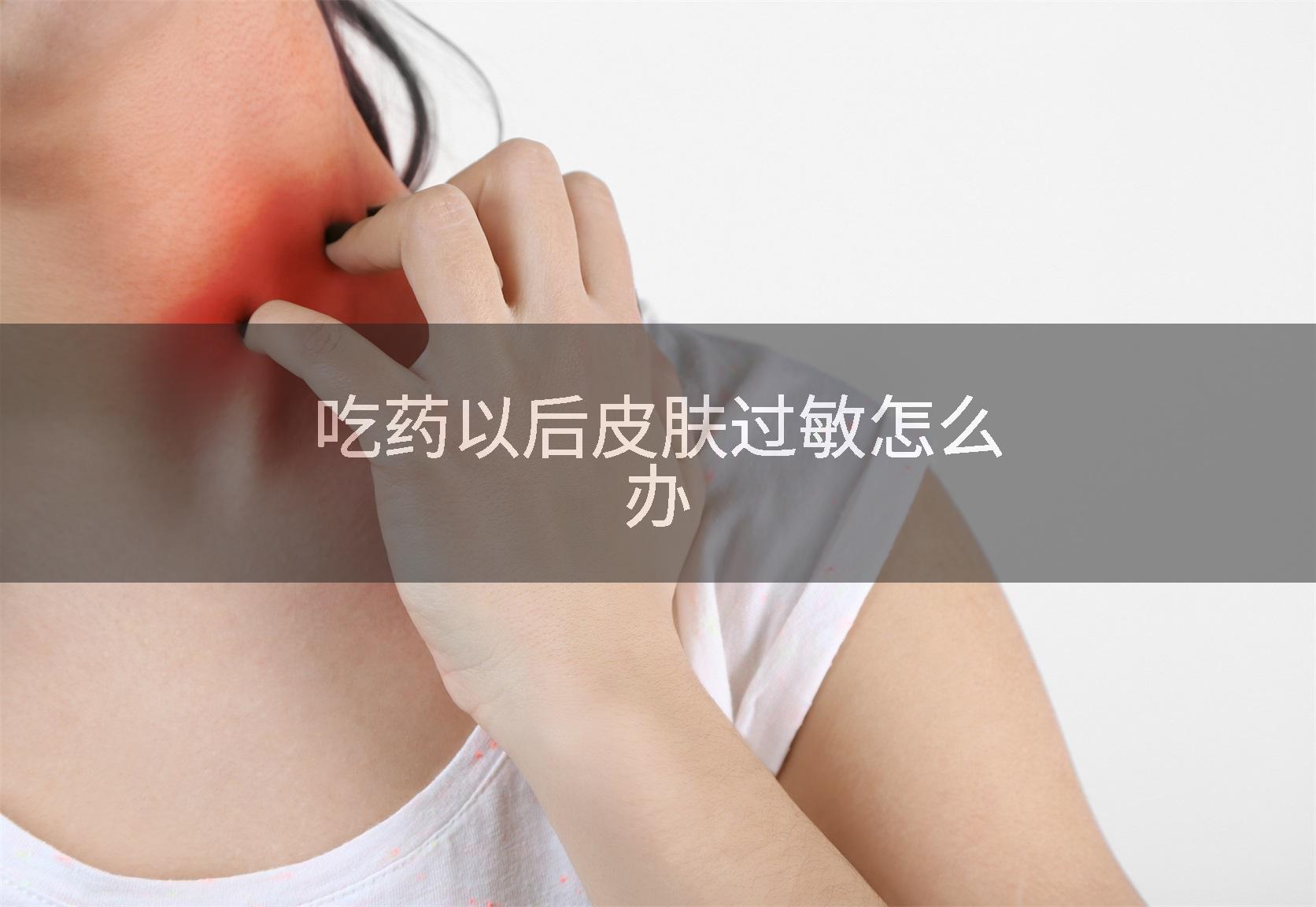 吃药以后皮肤过敏怎么办