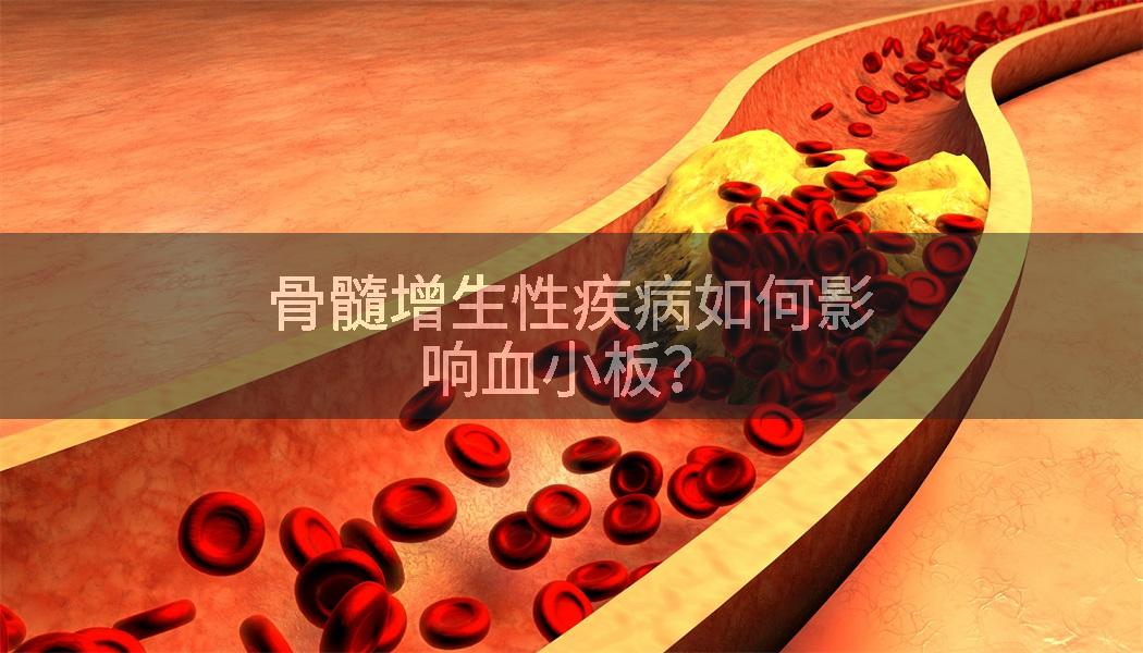 骨髓增生性疾病如何影响血小板？