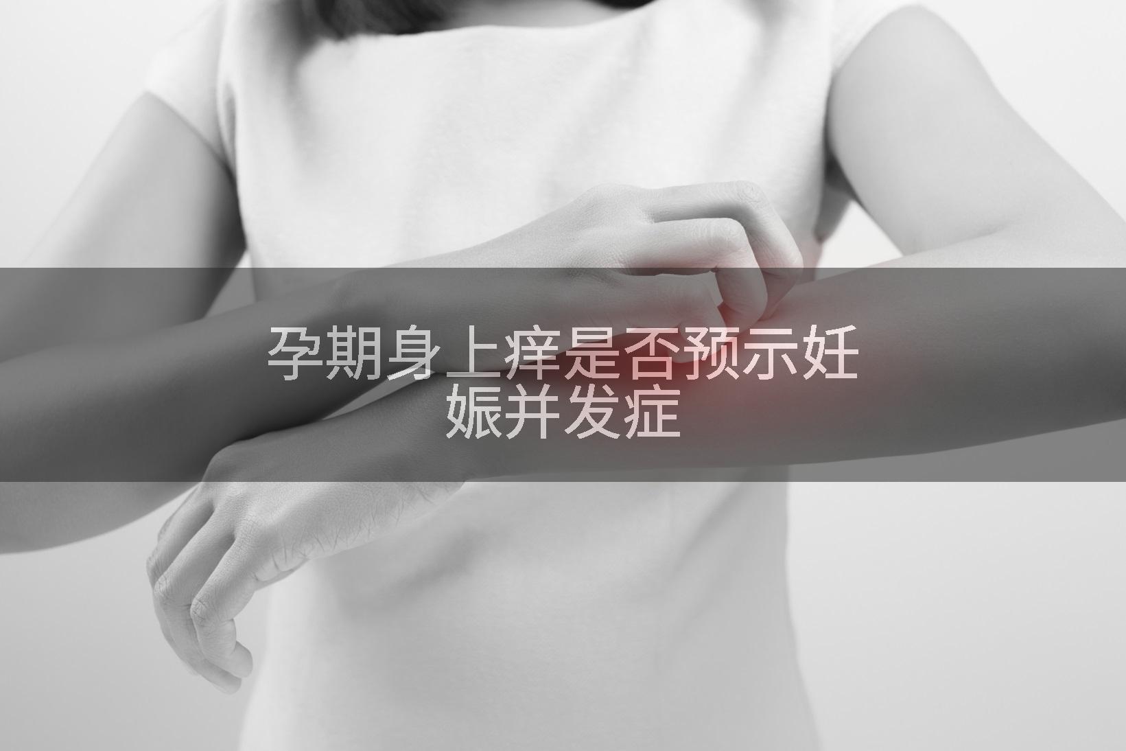 孕期身上痒是否预示妊娠并发症
