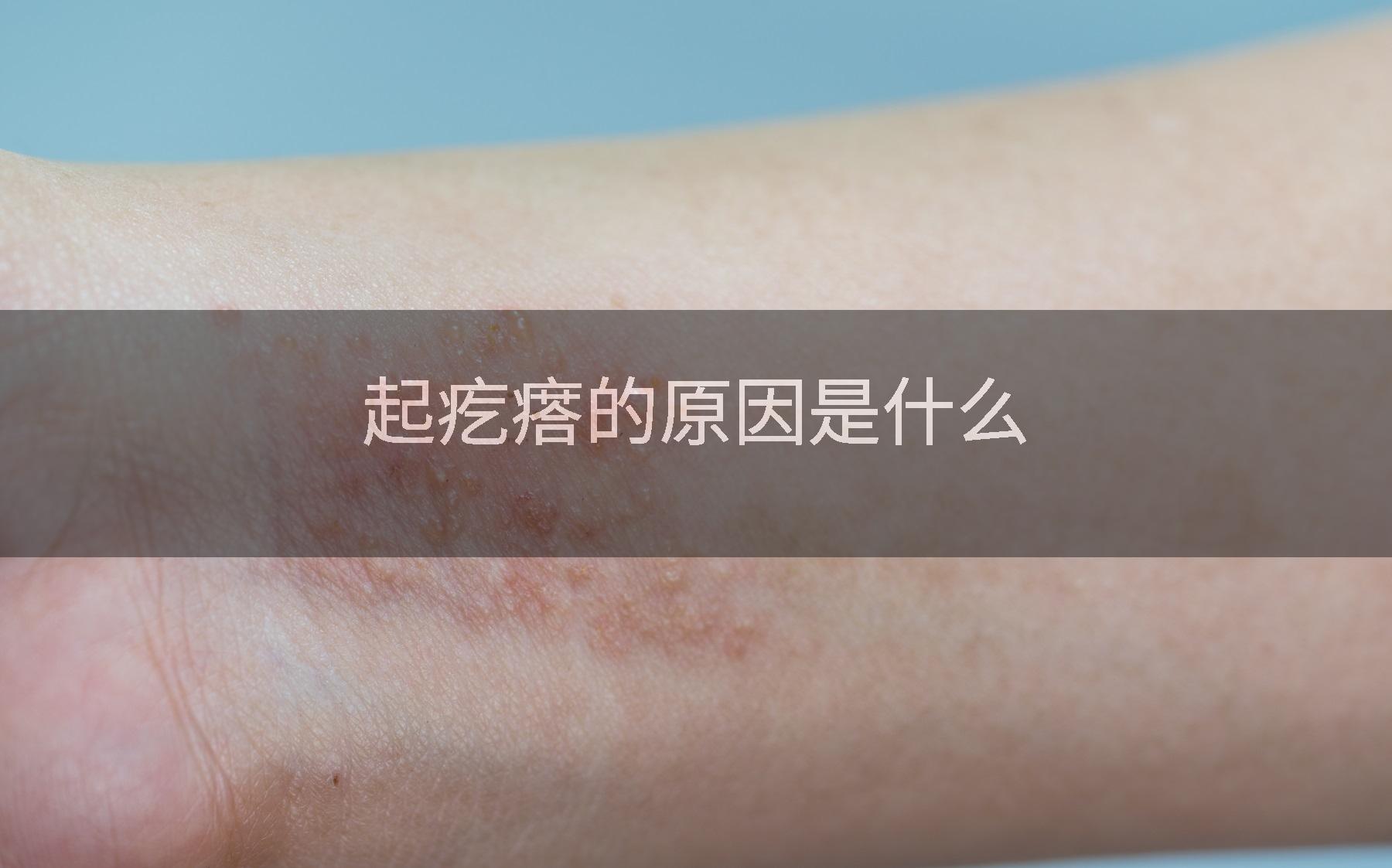 起疙瘩的原因是什么