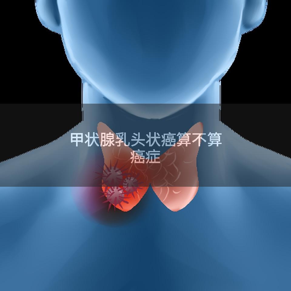 甲状腺乳头状癌算不算癌症