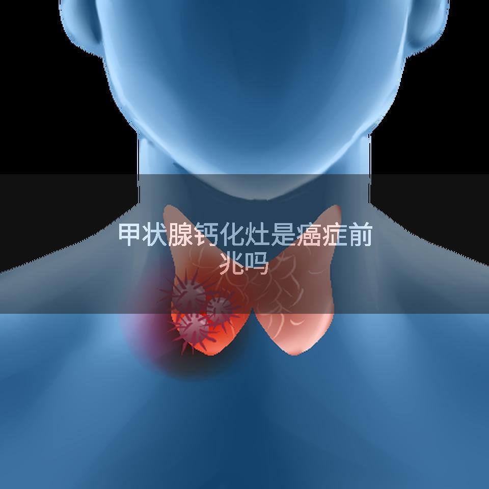 甲状腺钙化灶是癌症前兆吗