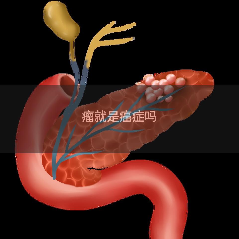 瘤就是癌症吗