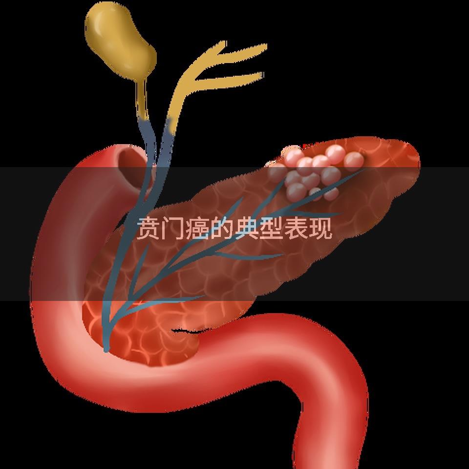 贲门癌的典型表现