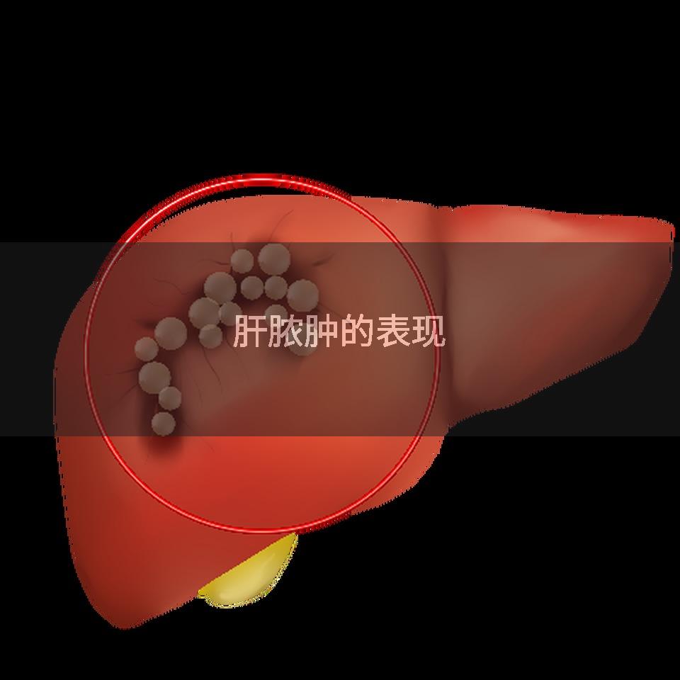 肝脓肿的表现