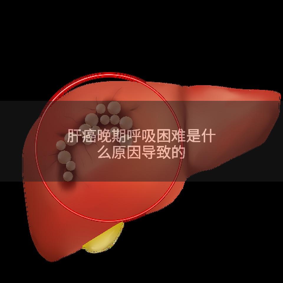 肝癌晚期呼吸困难是什么原因导致的