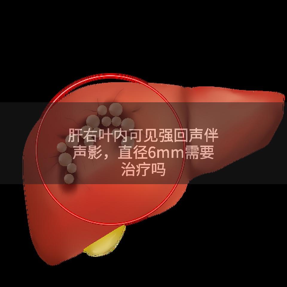 肝右叶内可见强回声伴声影，直径6mm需要治疗吗