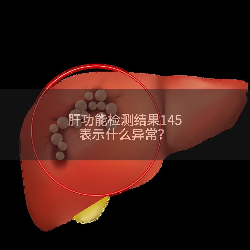 肝功能检测结果145表示什么异常？