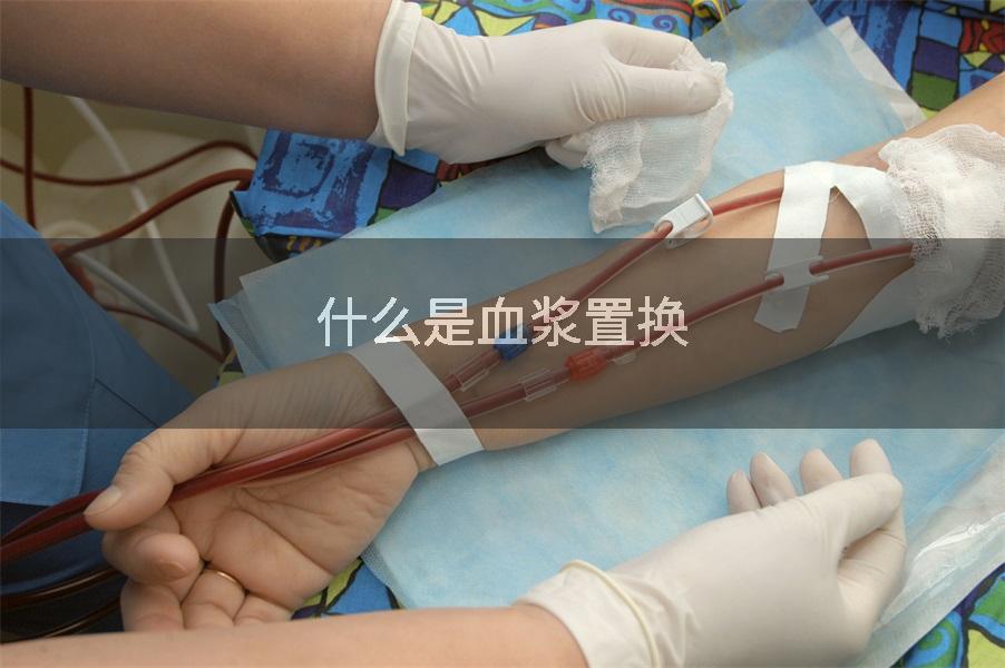 什么是血浆置换