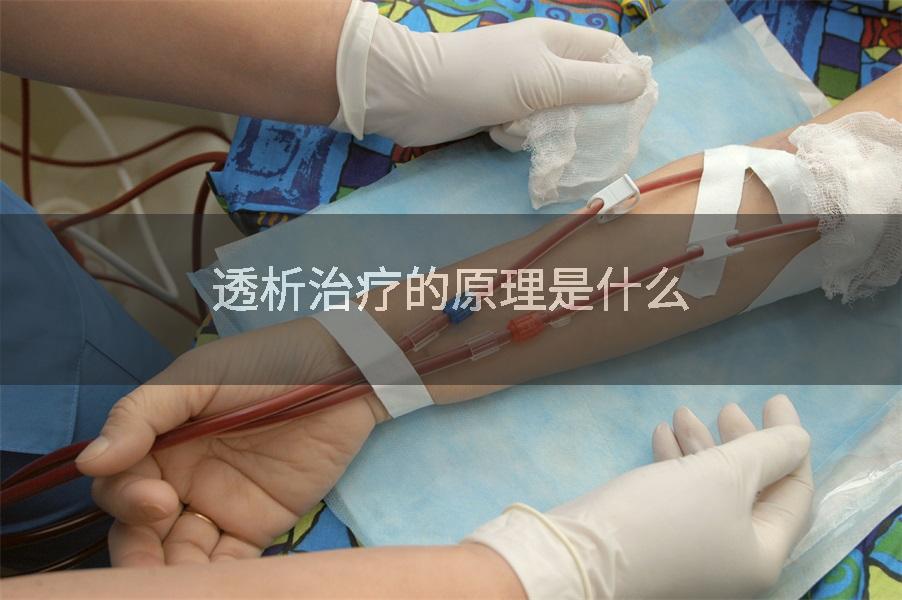 透析治疗的原理是什么