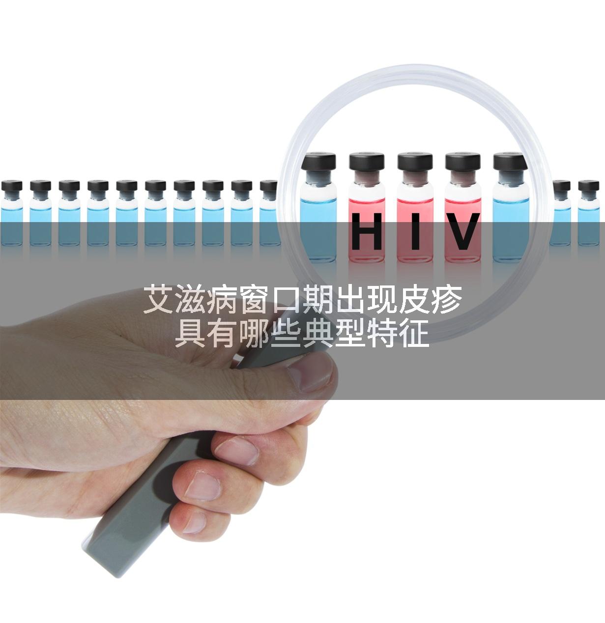 艾滋病窗口期出现皮疹具有哪些典型特征
