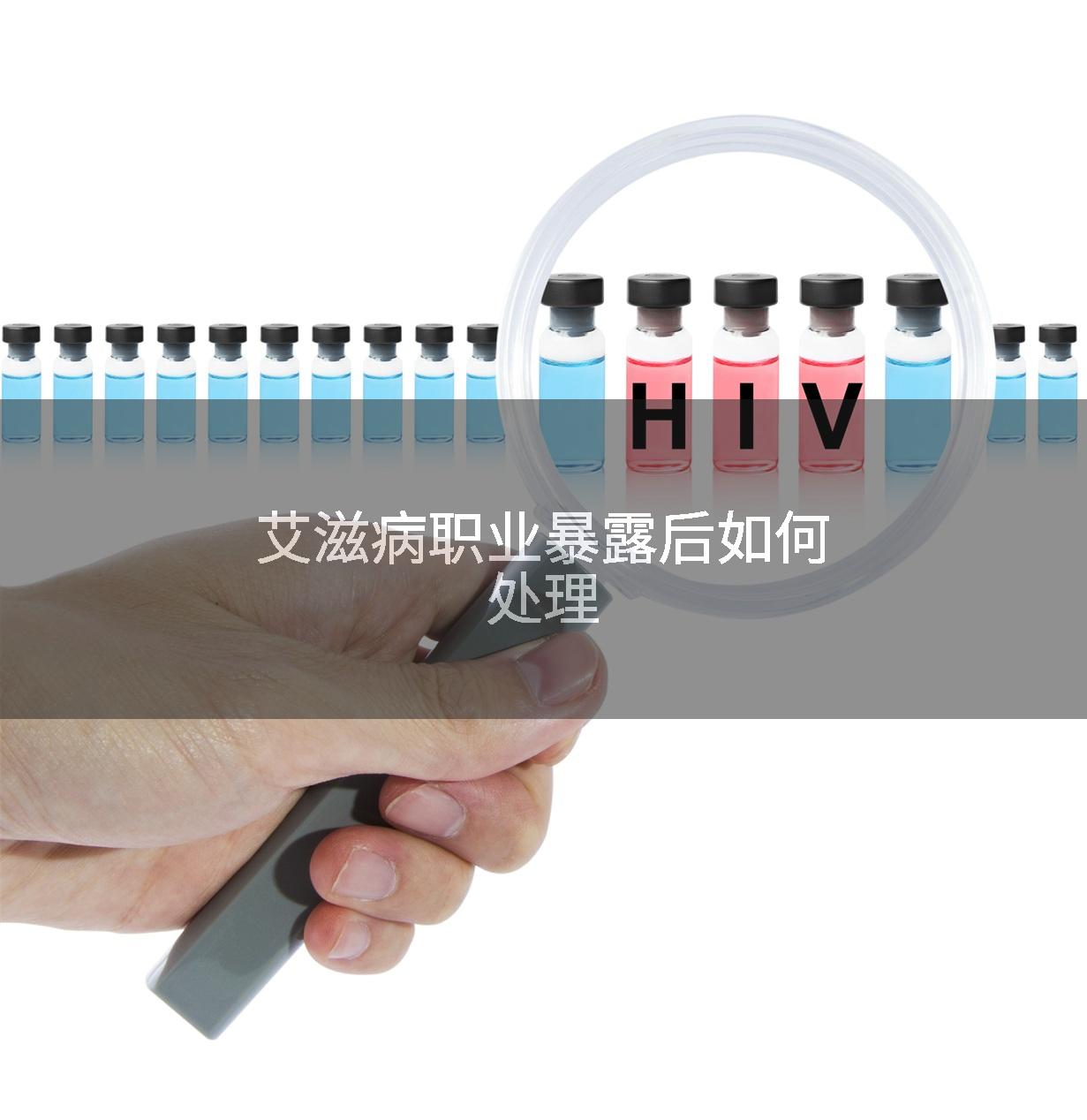 艾滋病职业暴露后如何处理