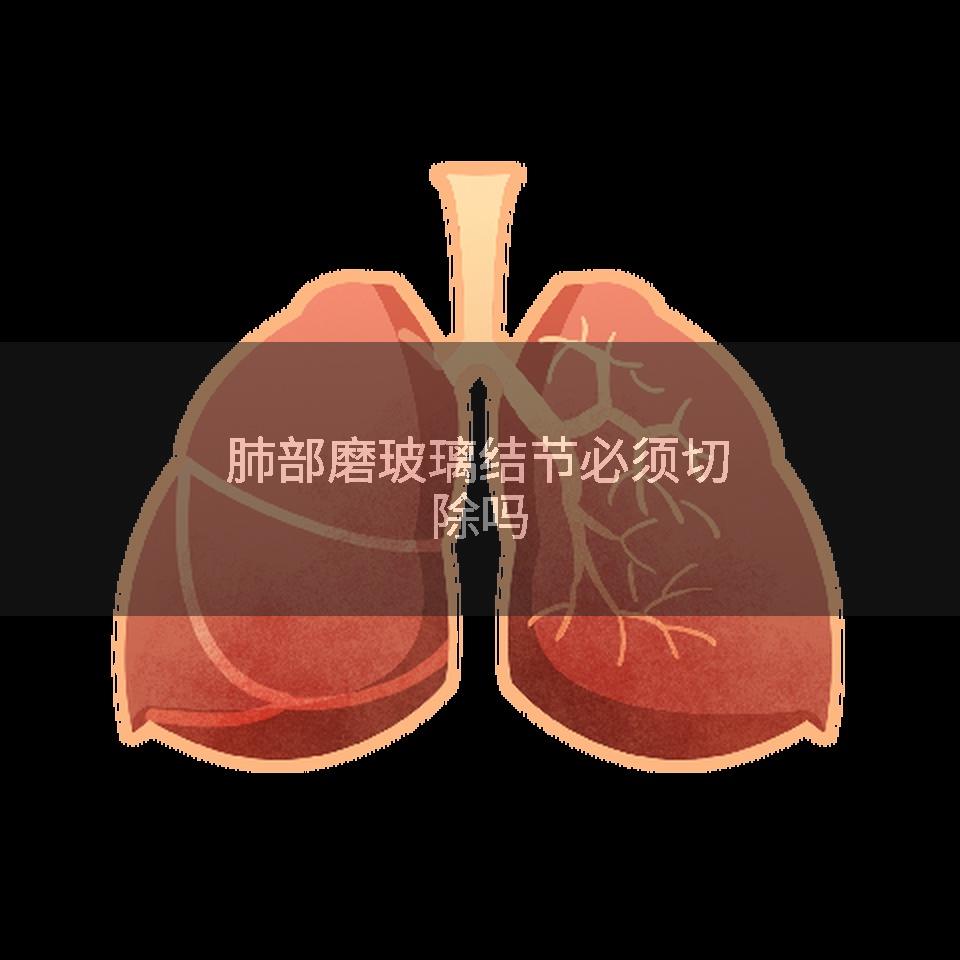 肺部磨玻璃结节必须切除吗