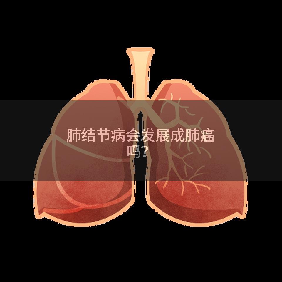 肺结节病会发展成肺癌吗？