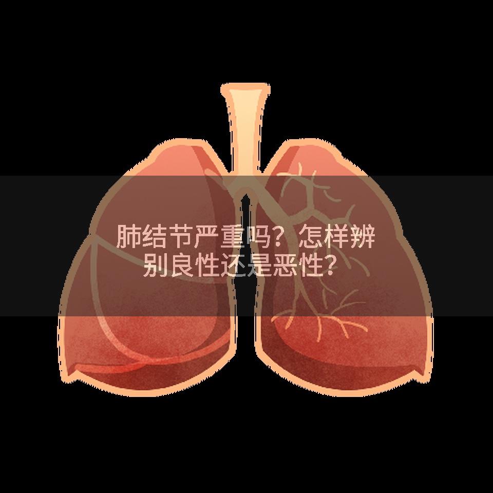 肺结节严重吗？怎样辨别良性还是恶性？