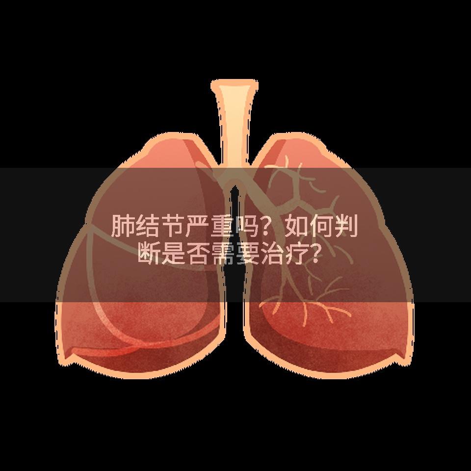 肺结节严重吗？如何判断是否需要治疗？